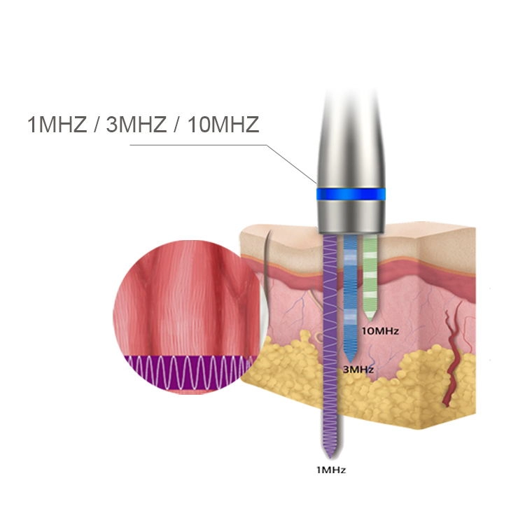 LDM Noblesse 10 ميجا هرتز بالموجات فوق الصوتية العلاج 3 في 1 بالموجات فوق الصوتية إزالة التجاعيد إزالة الجمال التخسيس جهاز العناية بالوجه أداة